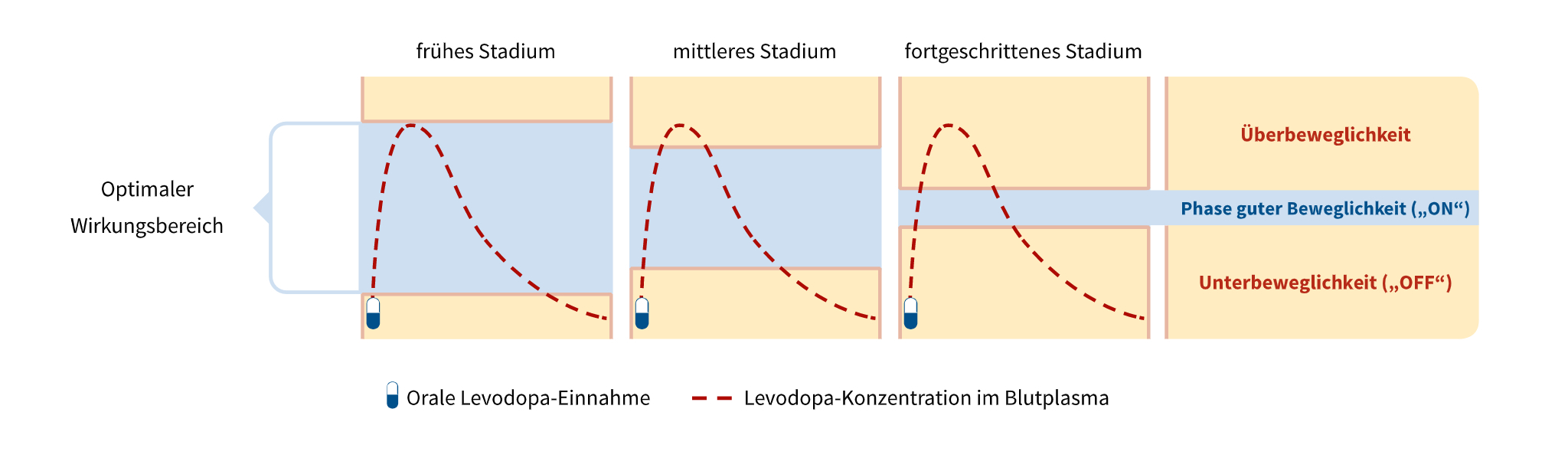 Funktionsweise von Parkinson