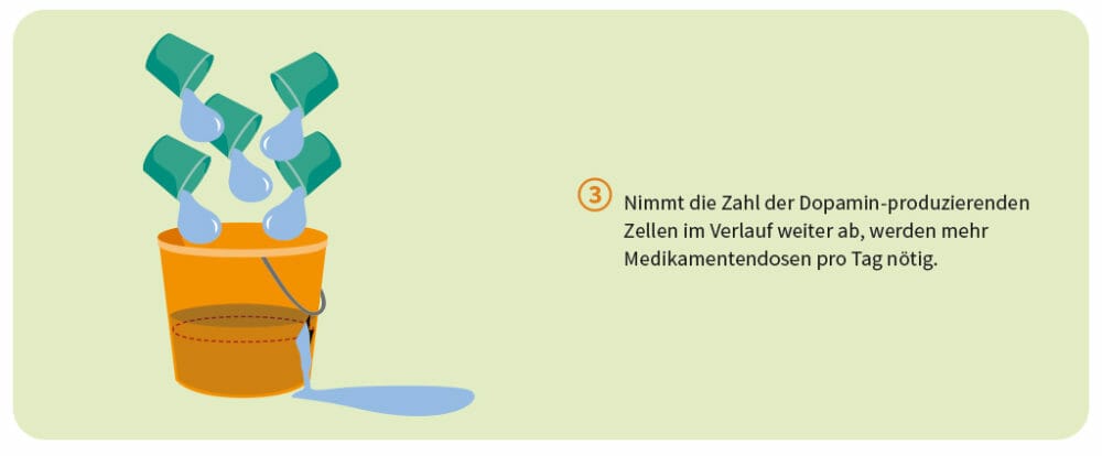 Den Dopaminverlust ausgleichen