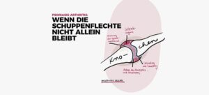Wenn die Schuppenflechte nicht alleine bleibt