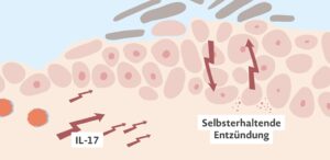 Selbsterhaltende Entzündung