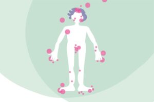 Illustration Körper mit entzündeten Stellen