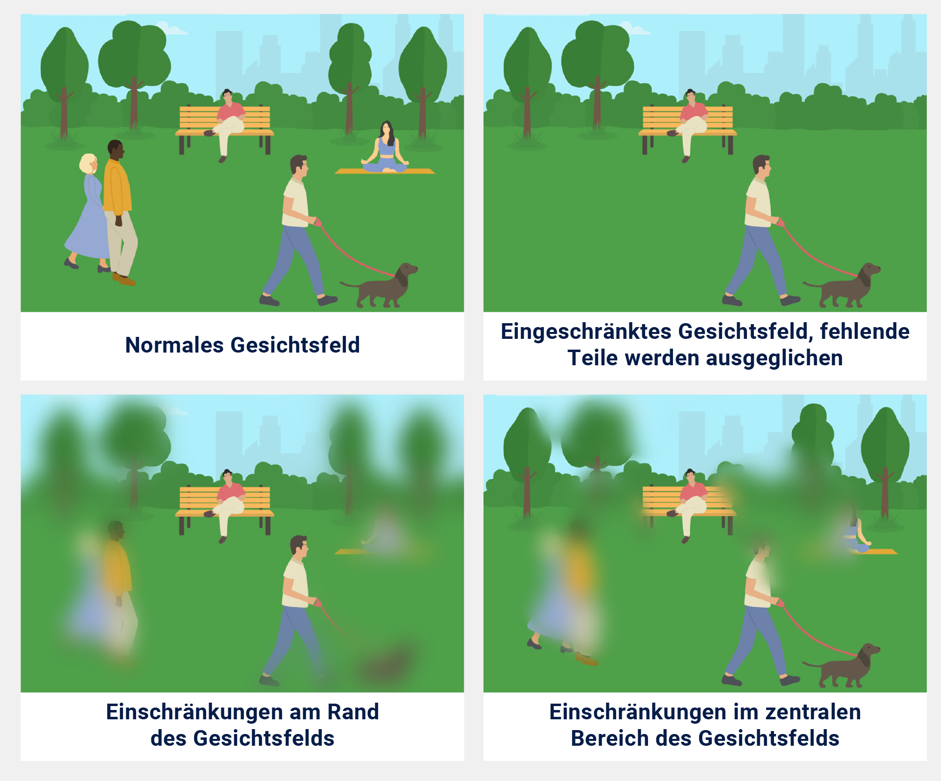 Symptome beim Glaukom