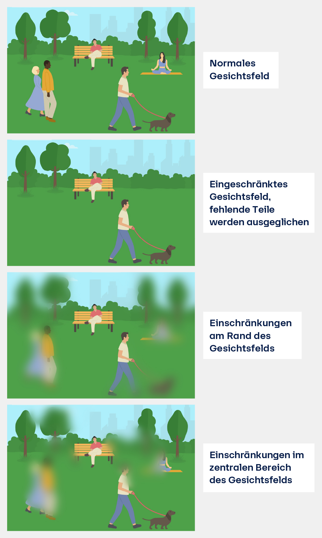 Symptome beim Glaukom