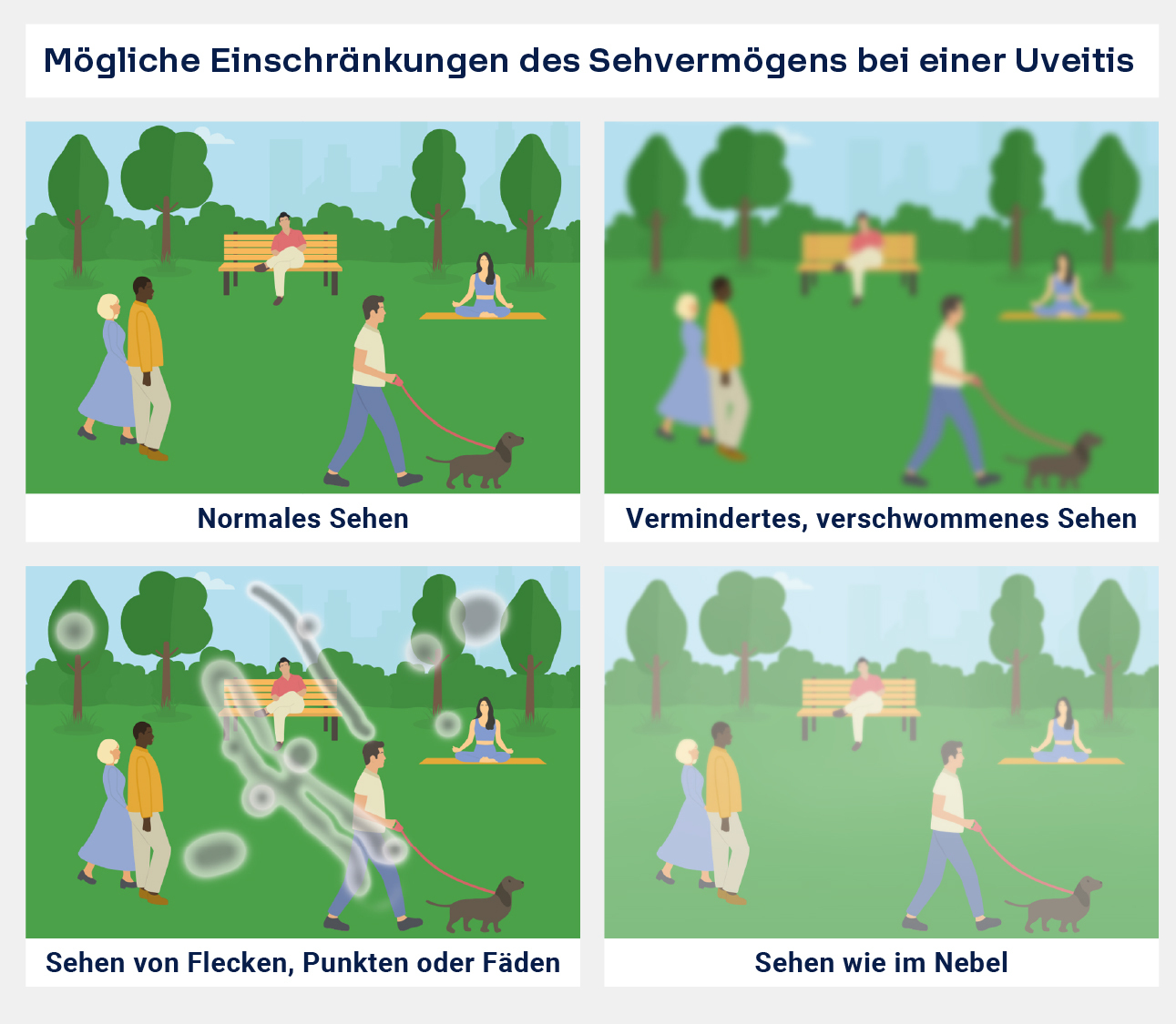 Einschränkungen des Sehens bei Uveitis