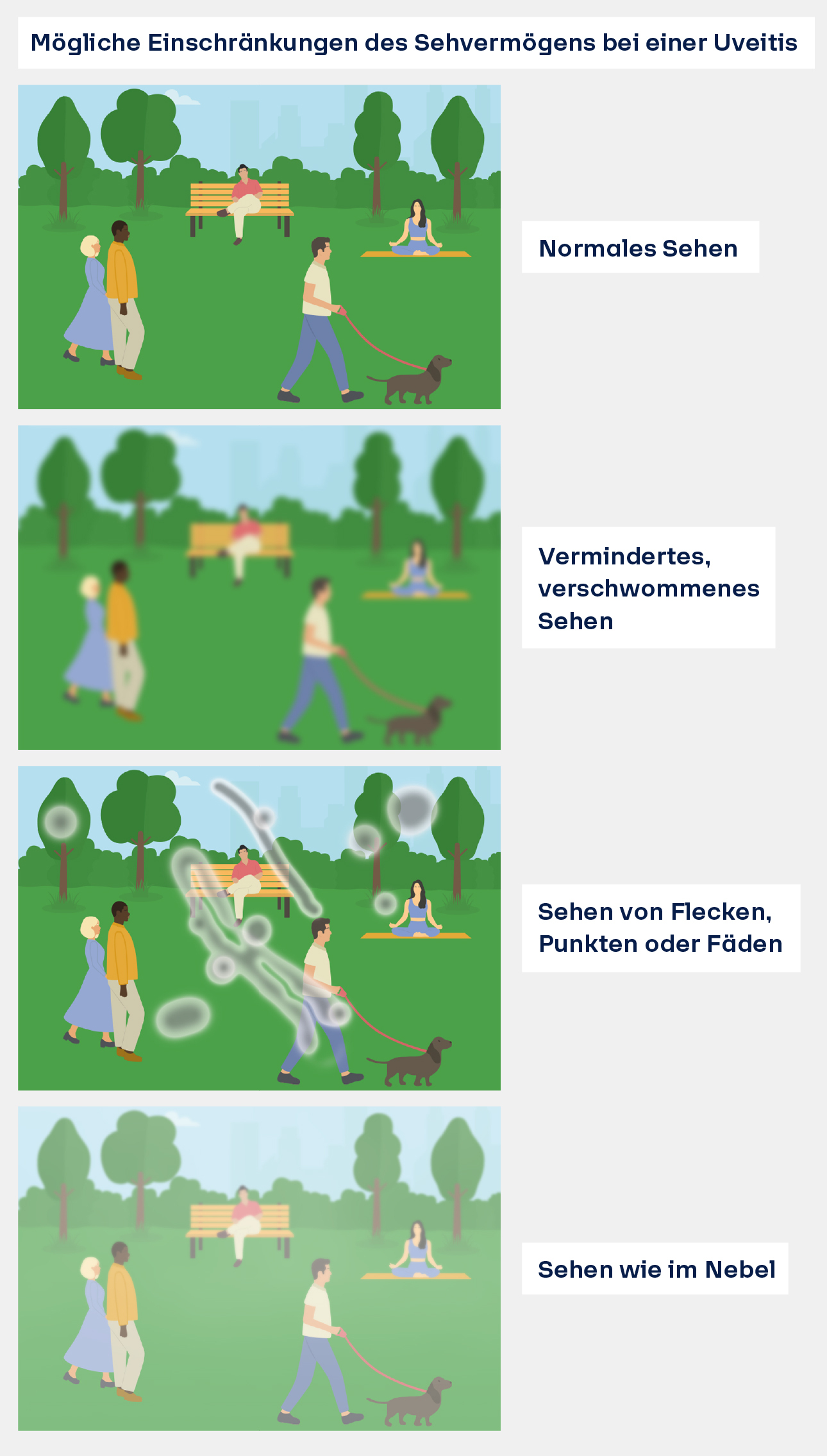 Einschränkungen des Sehens bei Uveitis