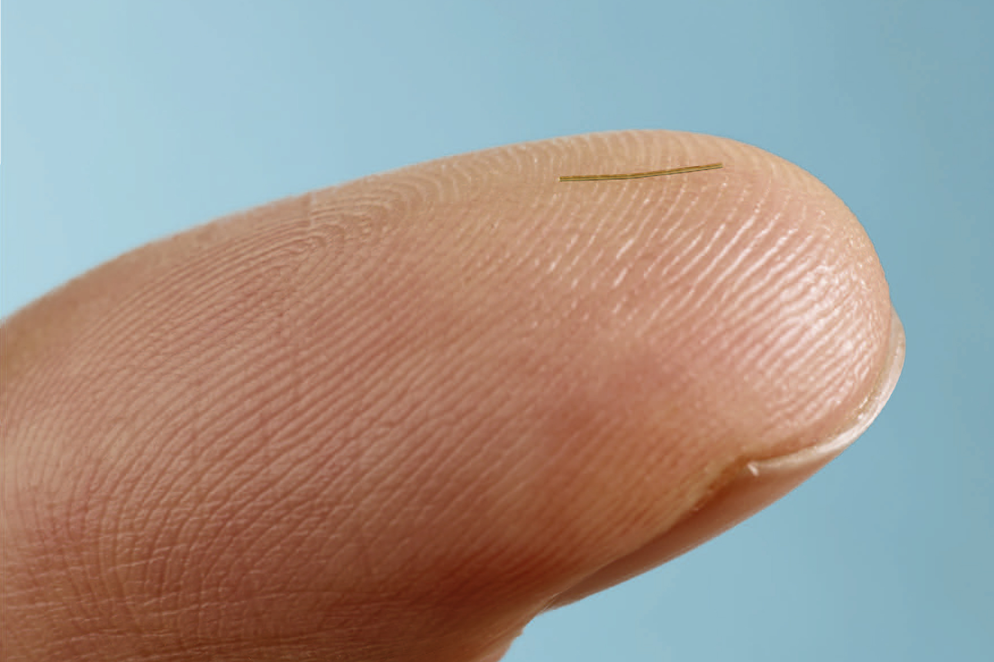 das XEN Gelimplantet ist stark rangezommt auf einem Finger zu sehen