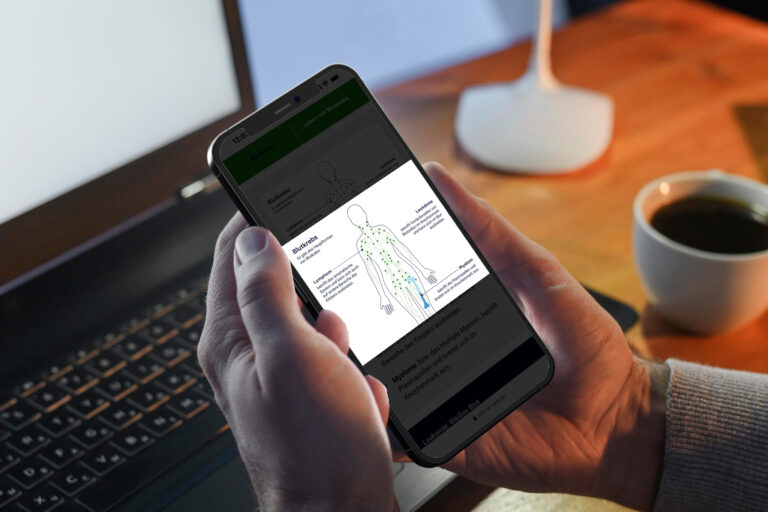 Darstellung der CED Disk von AbbVie auf einem Tisch