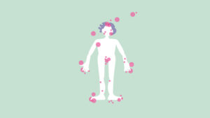 Illustration eines Körperes mit betroffenen Stellen von Psoriasis