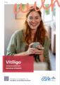 Titelbild Vitiligo verstehen & behandeln