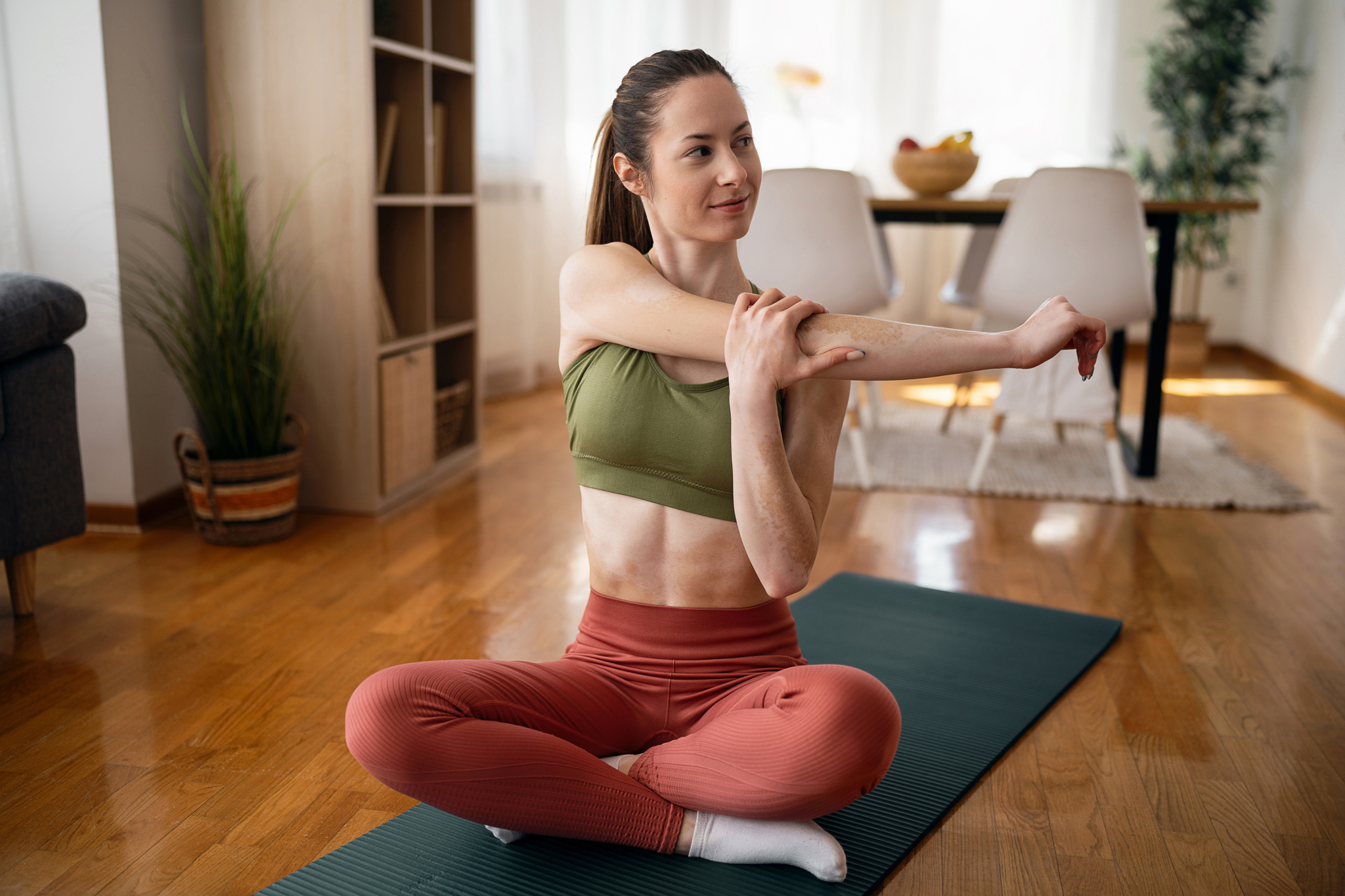 Frau mit Vitiligo sitzt auf einer Yogamatte und macht eine Übung